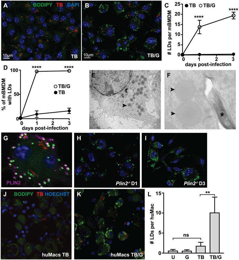 Confocal microscopy of macrophage lipid droplets during M. tuberculosis infection, highlighting IFN-gamma-dependent host lipid remodeling.