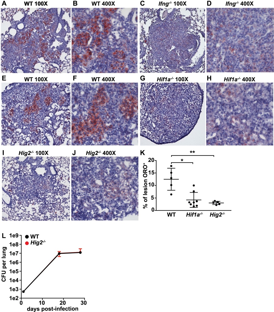 Oil Red O tissue image showing lipid droplet formation in tuberculosis lesions, supporting in vivo host-pathogen lipidomics context.