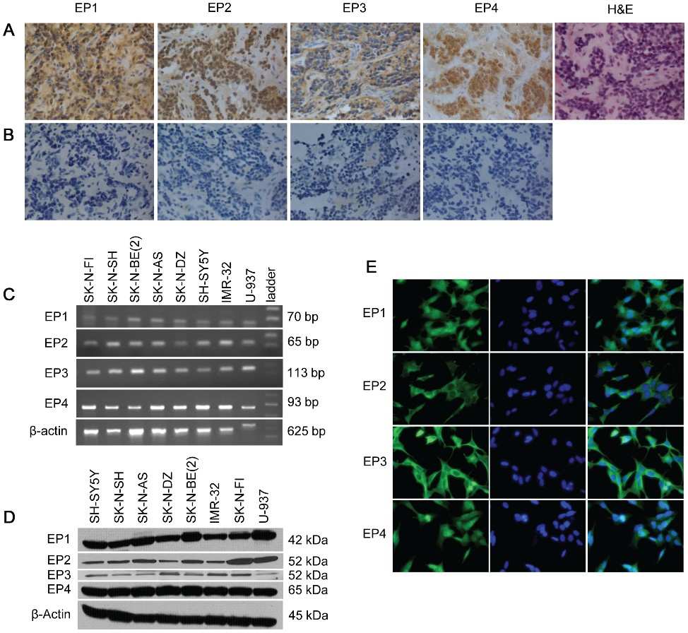 Neuroblastoma cells express EP1–EP4 and generate PGE₂, supporting autocrine/paracrine survival signaling in tumours.