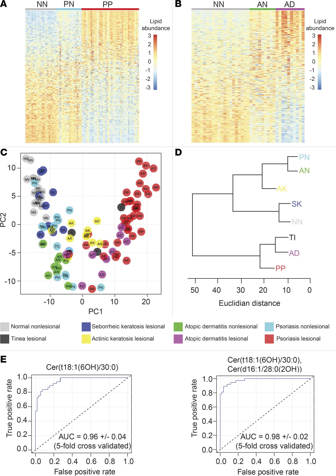 ROC curve from Camera et al., JCI Insight (2022), Figure 10E (right panel): two-analyte epidermal lipid classifier highlighting psoriasis discrimination.