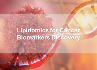 Lipidomics for Cancer Biomarkers Discovery
