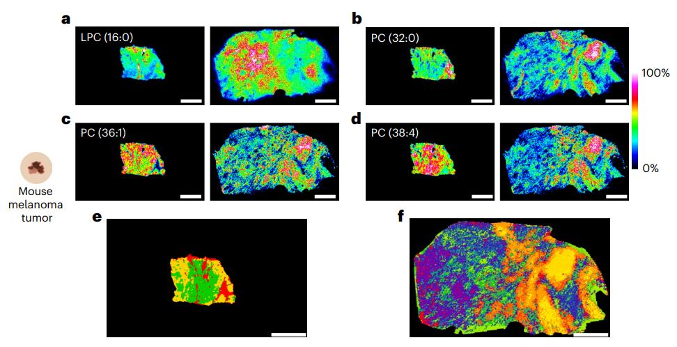 Side-by-side lipid ion images of tumor tissue before and after TEMI expansion with clustering segmentation, revealing increased spatial resolution and metabolic heterogeneity.