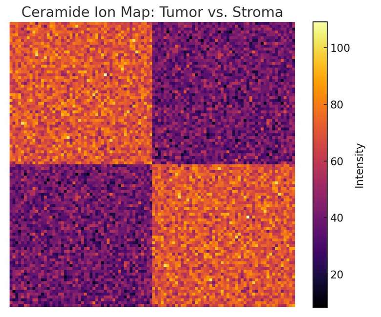 Ceramide Ion Map: Tumor vs. Stroma