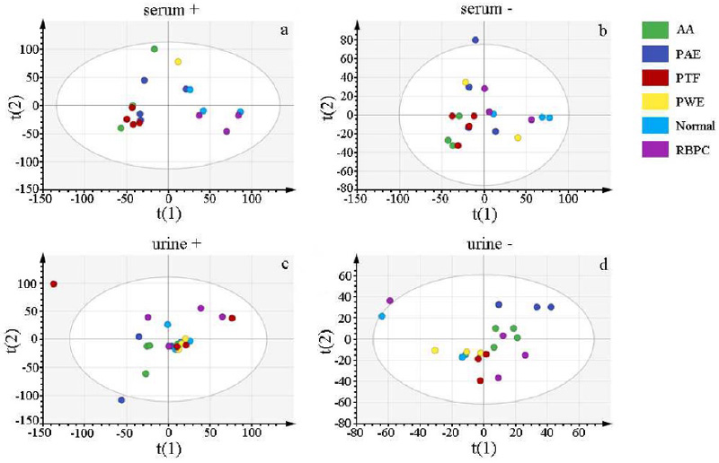 PCA score plots showing group separation based on untargeted lipidomics profiles in serum and urine.